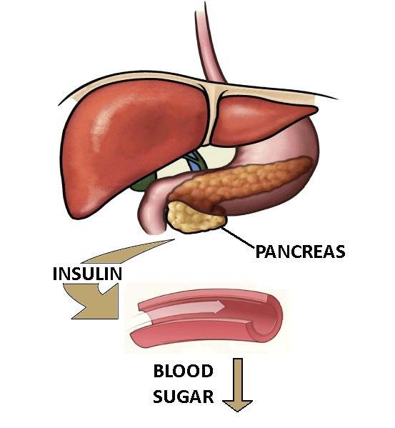 Diagram of pancreas showing insulin release and blood sugar regulation