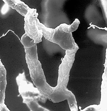 Microscopic view of damaged brain blood vessels, blood-brain barrier health concept