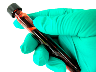 Gloved hand holding blood sample vial for thyroid lab test