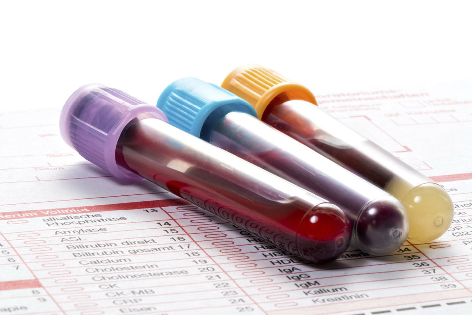 Cyrex Array 2 Intestinal Antigenic Permeability | Leaky Gut Panel