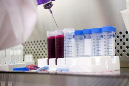Blood samples in laboratory test tubes for functional medicine or comprehensive health analysis