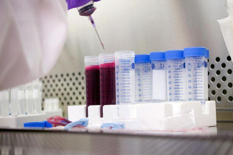 Blood samples in laboratory test tubes for functional medicine or comprehensive health analysis